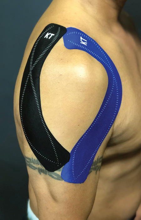 Exam Room - Is K-Tape the Answer to Your Aches and Pains