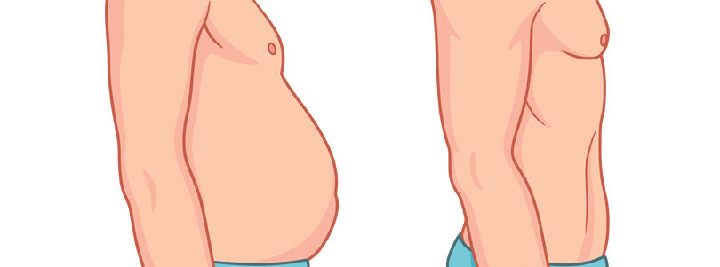 Ask the Doctor – Abdominoplasty Edition