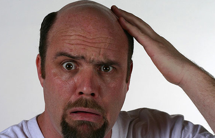 going bald guy